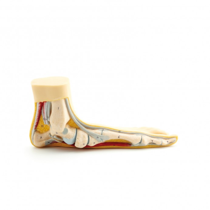Picioare pentru consultație – Picior Plat. 